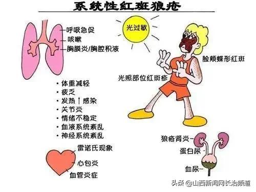 “与狼共舞”不再是梦——长治医学院附属和济医院肾内科救治一例肾衰竭合并脑出血患者