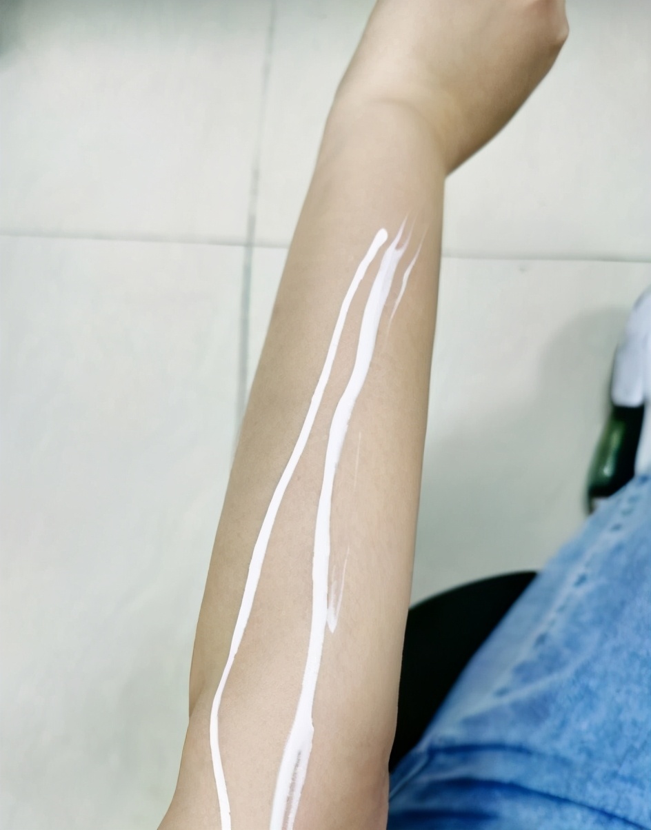 如何才能拥有好的皮肤,怎样才能拥有健康的皮肤