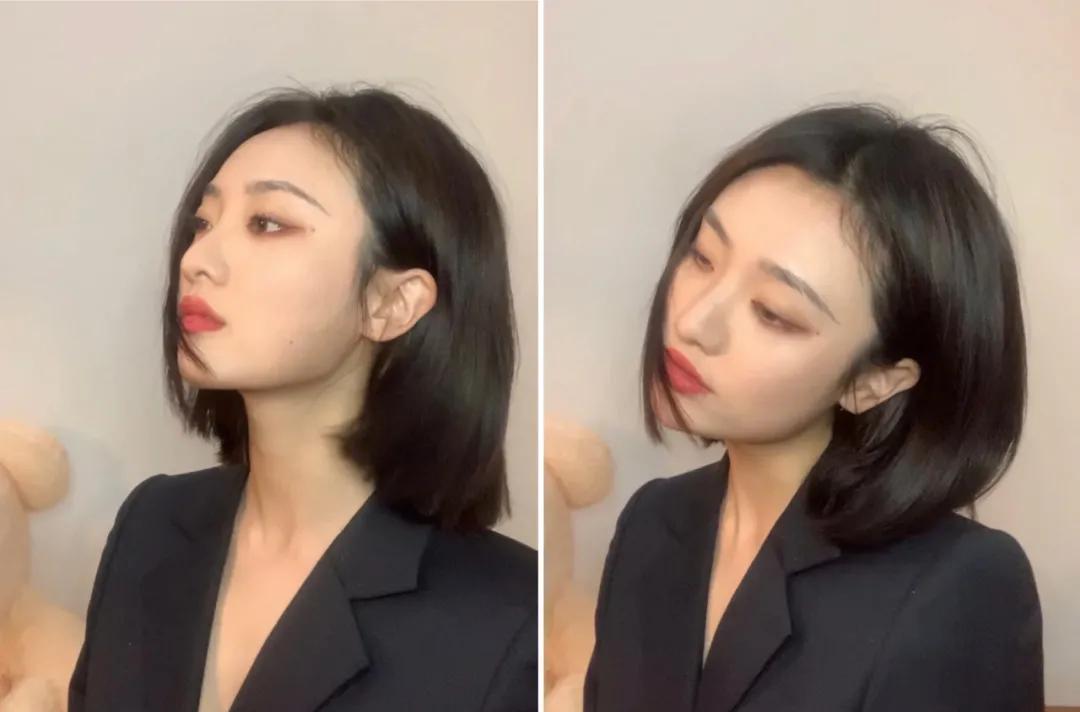 点痣就能变美,点痣整容大法