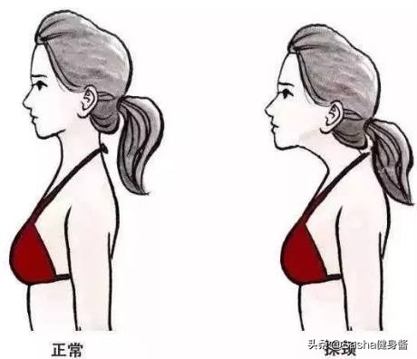 脖颈前伸腰背痛,都是探颈惹的祸,睡前做两个动作,改善探颈问题