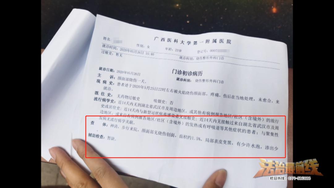 面部皮肤烫伤毁容图片,医院免费治疗毁容女孩