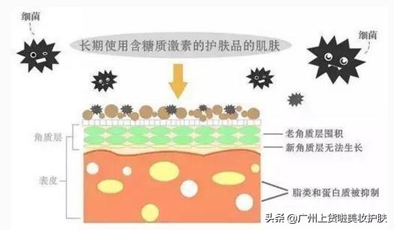得了激素过敏性皮炎怎么办,得了激素性皮炎记住一停二忍三调