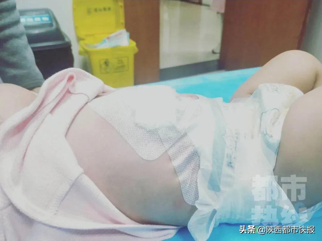 婴儿腹部有肿块,上海8个月女婴腹水肿胀如球