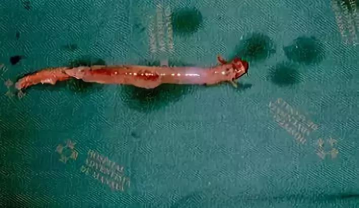 亚马逊河里的恐怖之处,亚马逊河里有多恐怖