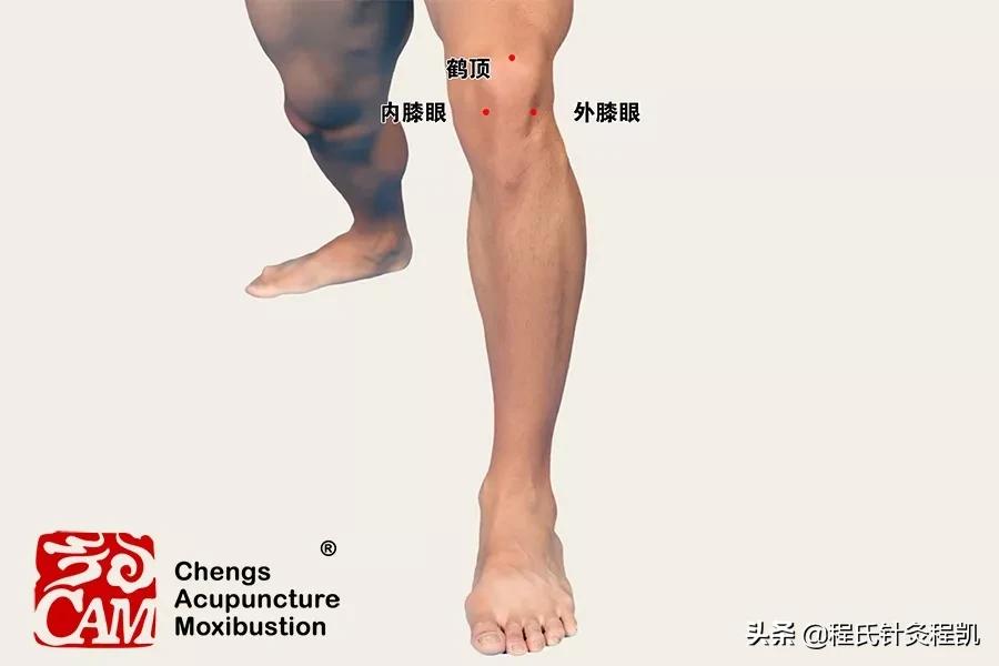 夏天膝寒膝痛是什么原因,膝痛的5个原因