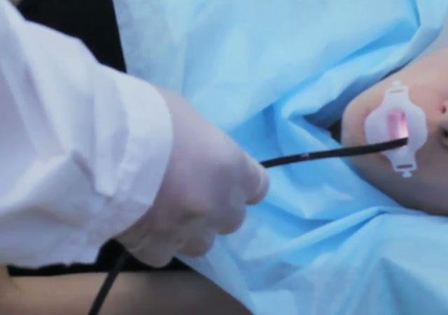 做一般胃镜检查前应注意哪些方面,胃镜检查具体是怎么做的