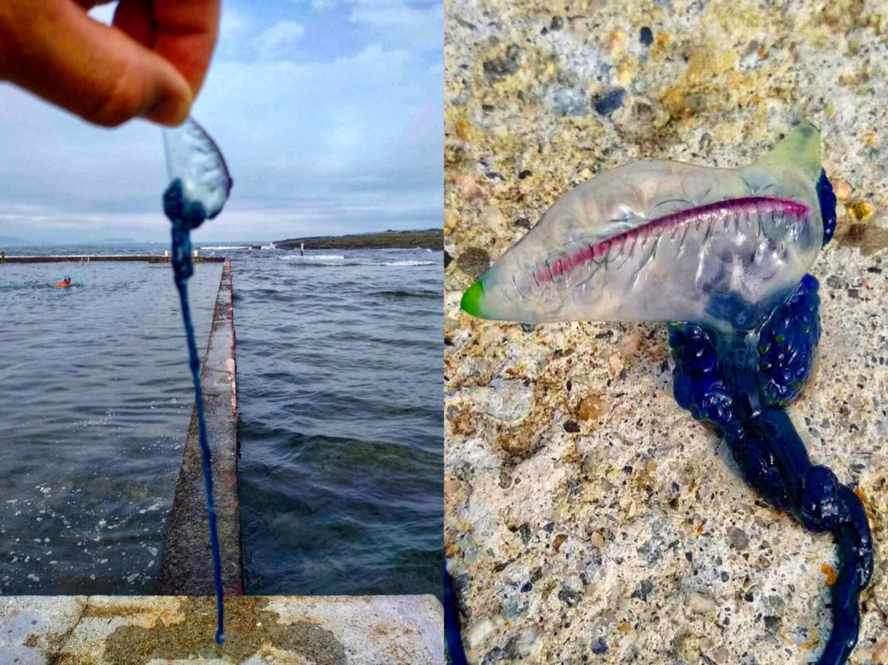 被棕色小点的水母蛰了该怎么办,被北海的小水母蛰了怎么办