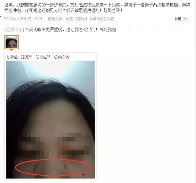 网红隆鼻精油有用吗,揭穿精油骗局