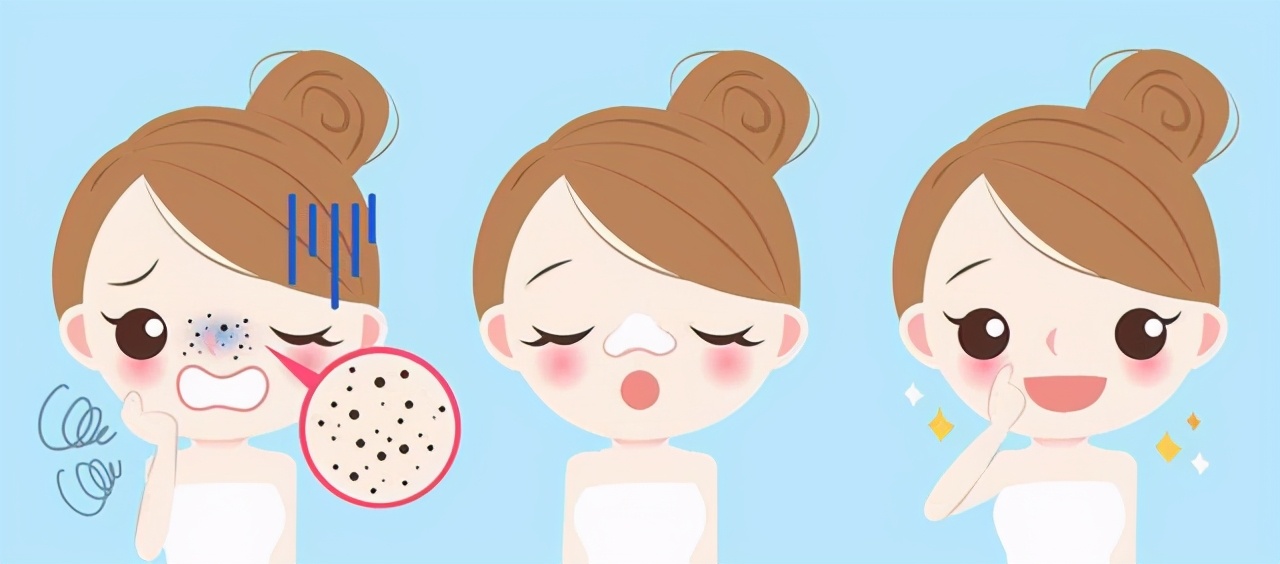 顽固黑头草莓鼻,去黑头小妙招学生党草莓鼻