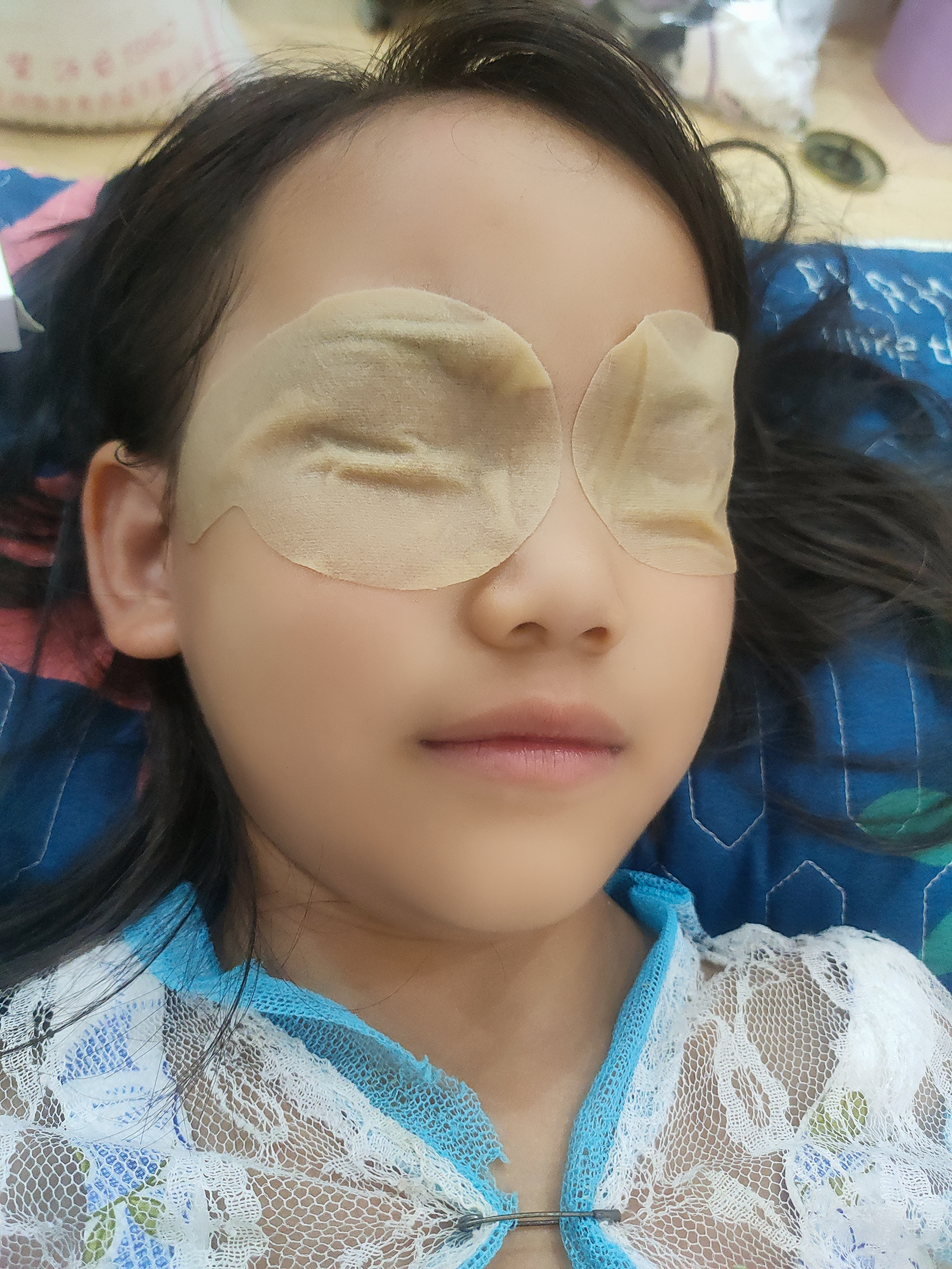 哪种眼贴缓解眼疲劳效果好,缓解眼疲劳眼贴哪种好