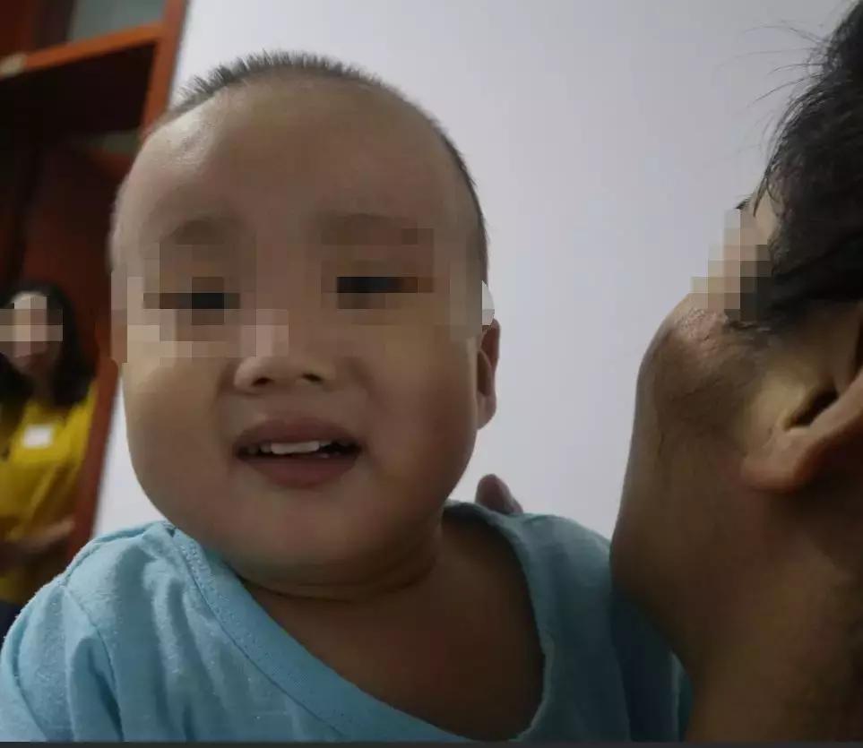 孩子脑积水反复发烧,婴儿脑积水引起发烧如何保守治疗