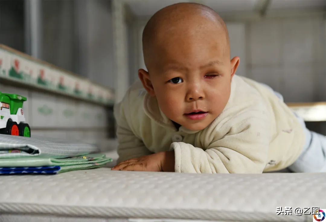 世上最悲催的婴儿,人间悲惨的孩子