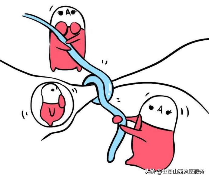 如何选择最适合自己最佳避孕方法,40以上适合的避孕方法