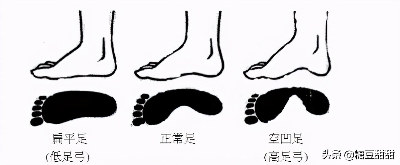 小白鞋烂大街了该穿什么鞋,小白鞋最近很火的