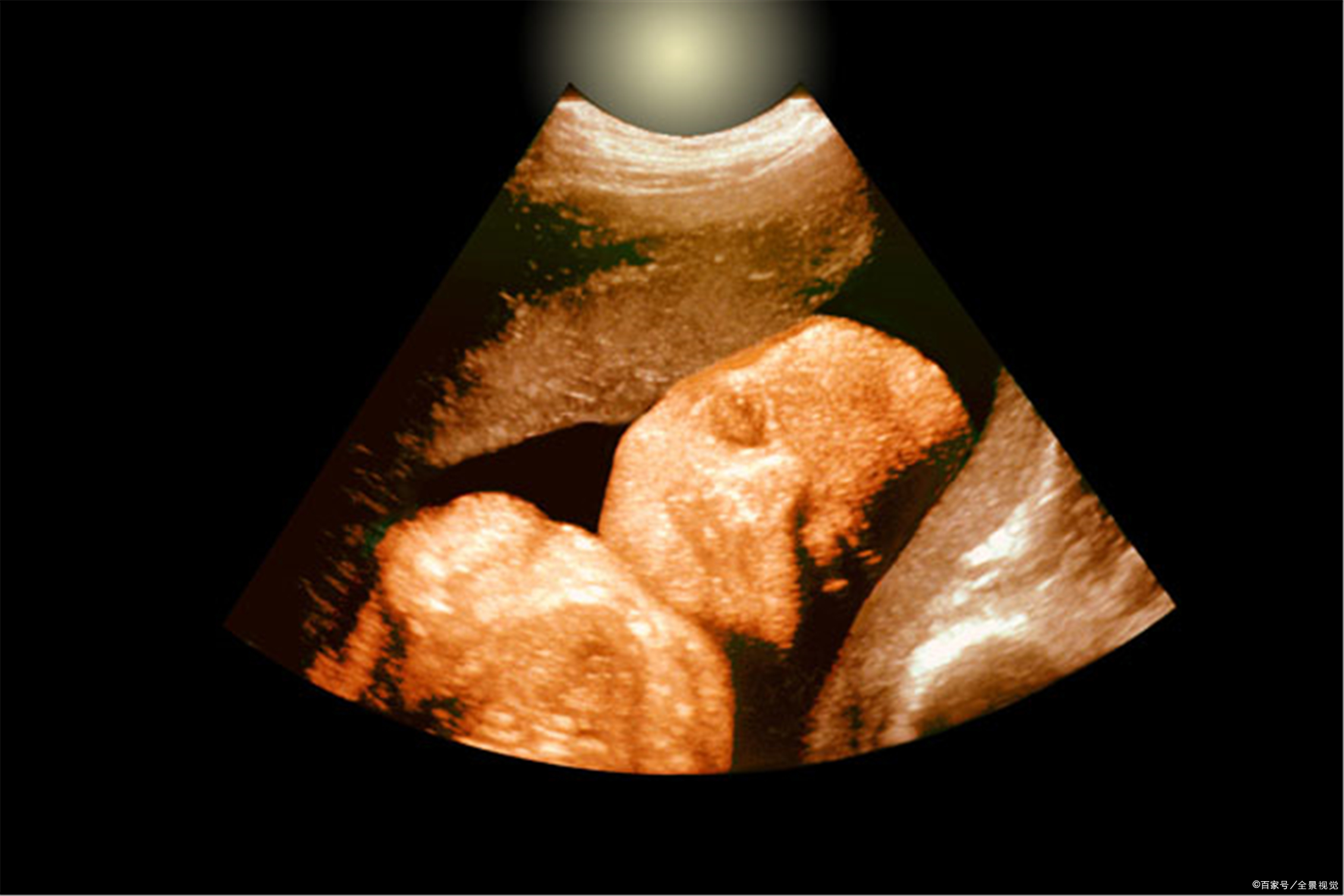 人的生殖生物学练习册,人的生殖课程讲解