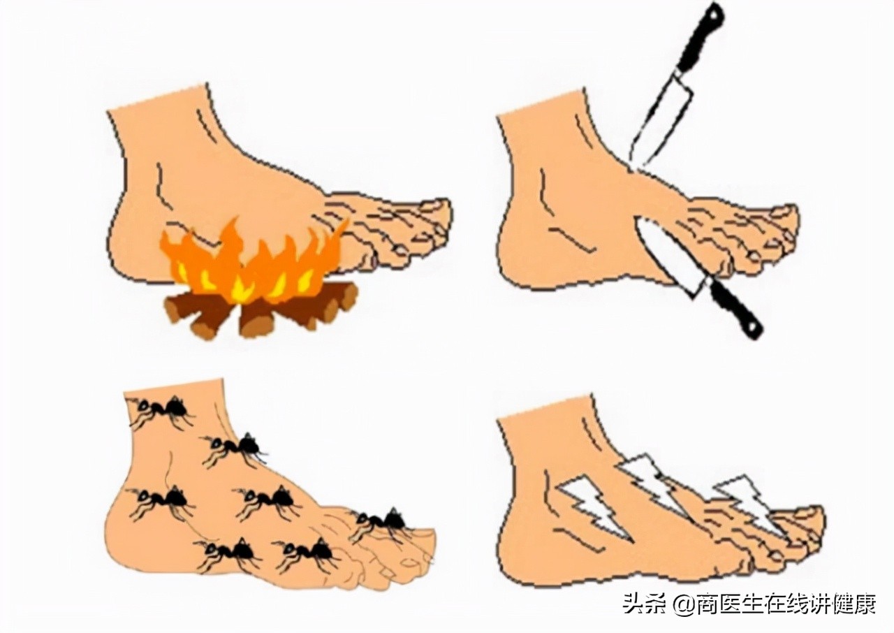 糖尿病神经病变需长期吃甲钴胺吗,糖尿病神经病变吃甲钴胺没有效果