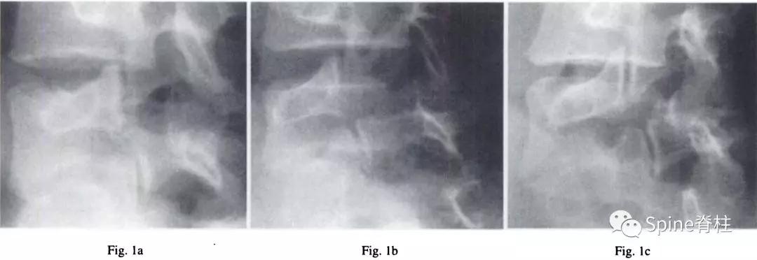 青少年一跑步就腰痛,青少年腰痛是什么原因引起的