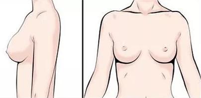 改善胸型内衣推荐购买,如何选择适合自己的内衣图解