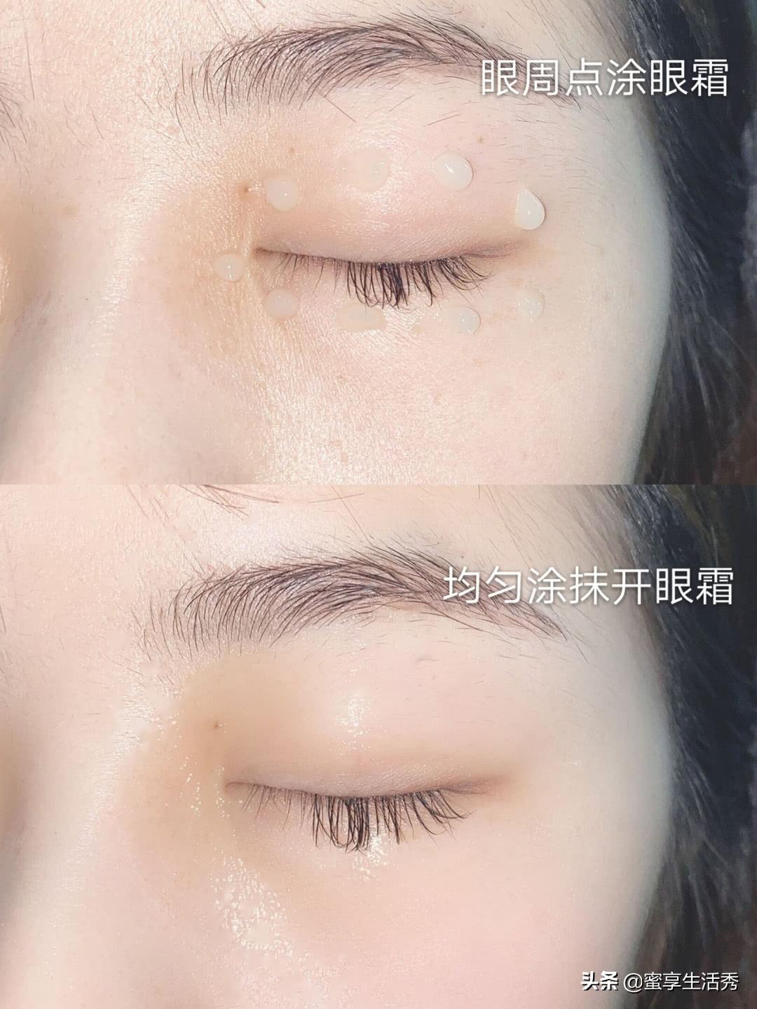 内双眼皮手术变外双效果,内双眼皮怎么变外双按摩最有效