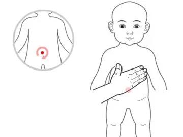 小儿积食发烧如何推拿,小儿推拿按摩积食发烧