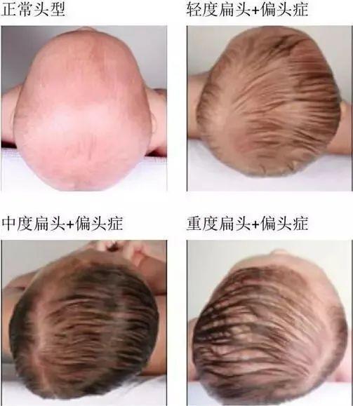 小孩从小跟爸爸睡和妈妈睡区别,宝宝从小睡枕头长大好不好