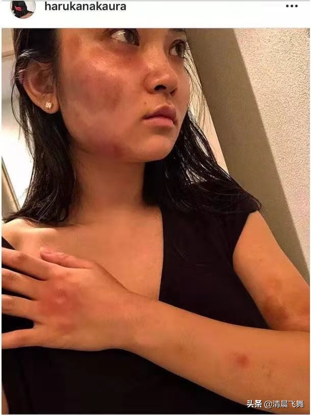 在孩子面前家暴的危害,家暴对家庭有什么危害