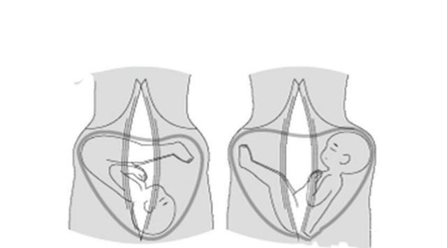 肚子不大就是很松弛怎么办,宝妈腹部松弛下垂可以手术吗