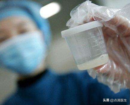 精子全项检查项目,精子全套详细检查