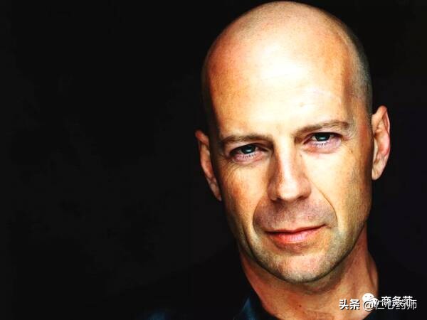 脱发真的没法治了吗,脱发真的是无药可治吗