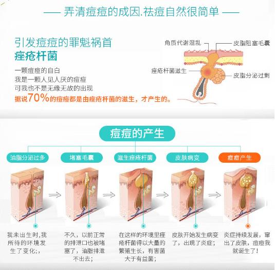 三天痘痘消失,三天不洗脸痘痘没了