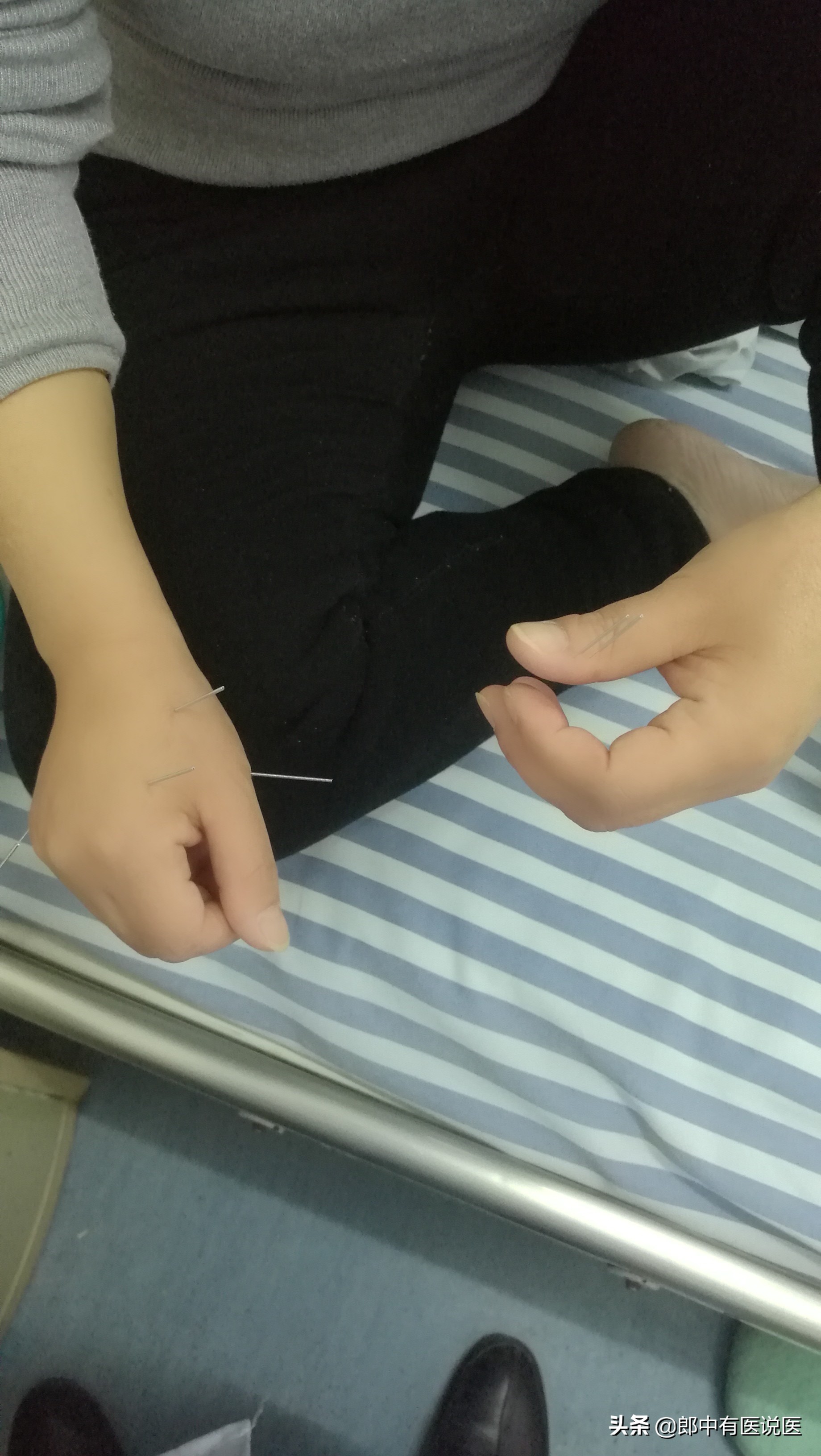 三叉神经痛剧烈疼痛怎么缓解,三叉神经痛治疗过程视频