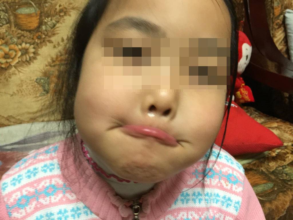孩子老是嘴干舔嘴唇唇边怎么办,小孩嘴唇可以涂唇膏吗