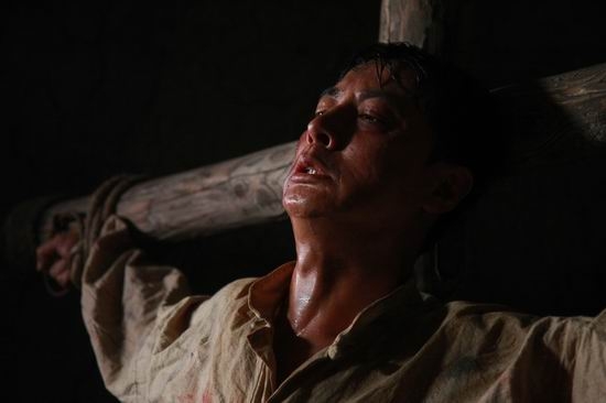 医生做手术时是怎么止血的,做手术流血怎么处理