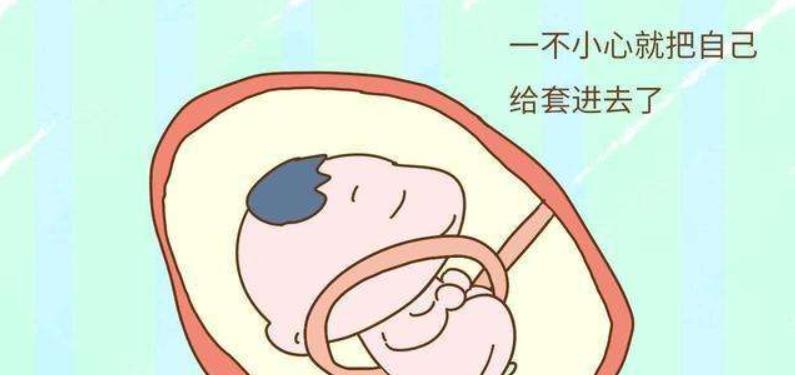 孕期胎儿绕颈？你必须知道这些