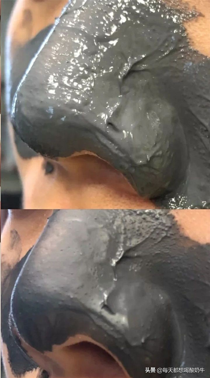 脸干长痘毛孔粗红血丝用什么修复,脸部泛红毛孔大怎么改善