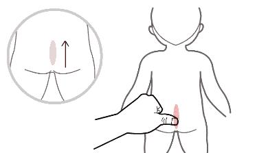 小儿推拿腹泻大便带粘液和血丝,宝宝腹泻拉血丝便小儿推拿有用吗
