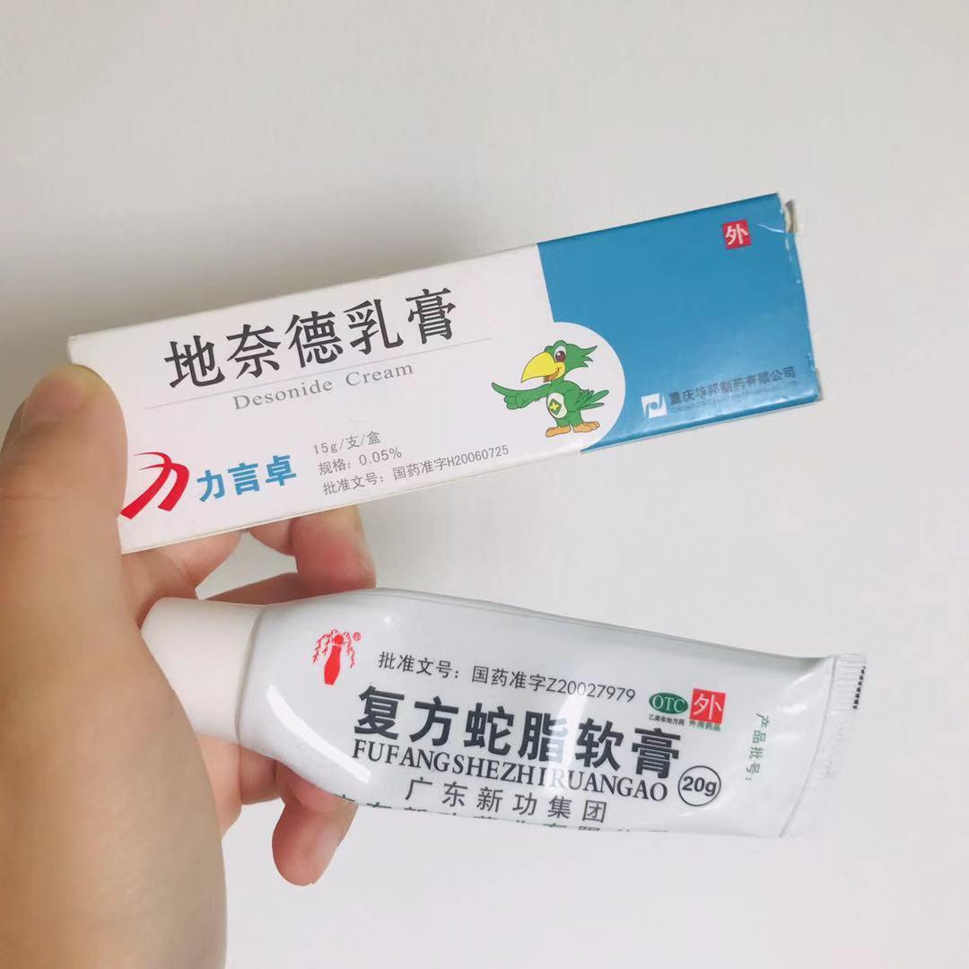 婴儿湿疹好了妈妈还用忌口吗,宝宝过敏湿疹中医的治疗方法