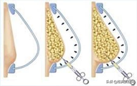 平胸丰胸最有效的方法,丰胸怎么学