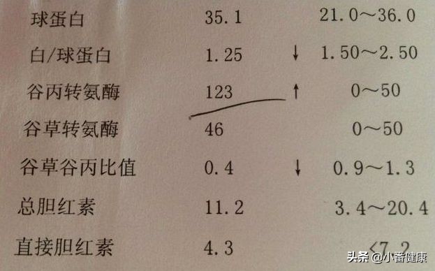 乙肝大三阳治疗方案,乙肝大三阳如何抗病毒治疗