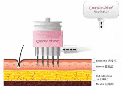 奥运选手都做了美甲,奥运换头选手