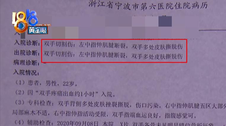 小张被浴室玻璃门割伤手，热搜第一！小伙误打误撞成了网红，刚刚记者又联系了小张