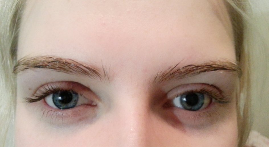 眼疲劳、眼干涩,8种常用人工泪液解读