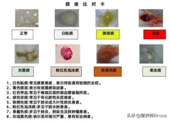 不咳嗽长期痰多,长期痰多咳嗽怎么办