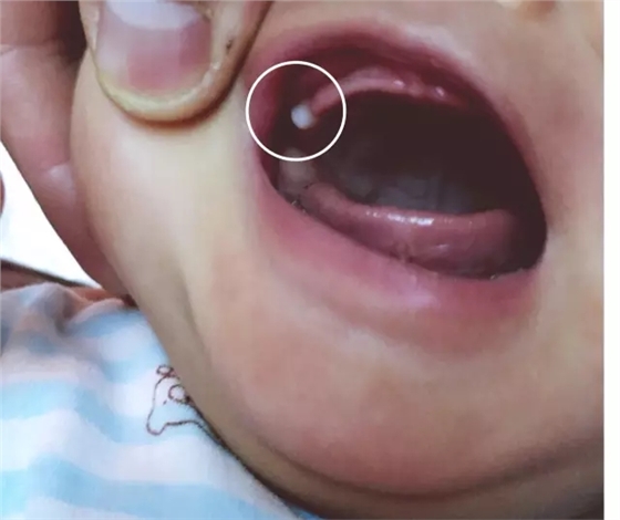 家有特殊孩子的最后怎么样了,家有特殊儿童