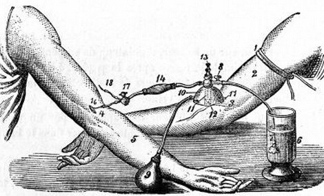 【树说】第二期-血疗