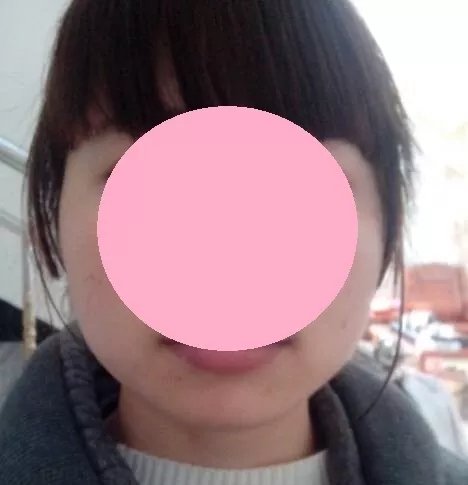 遮秃头又显脸小的刘海发型,头发遮大脸显脸小