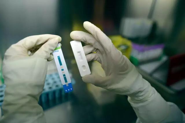 艾滋病检测试纸销售最多,艾滋病试纸十大排名