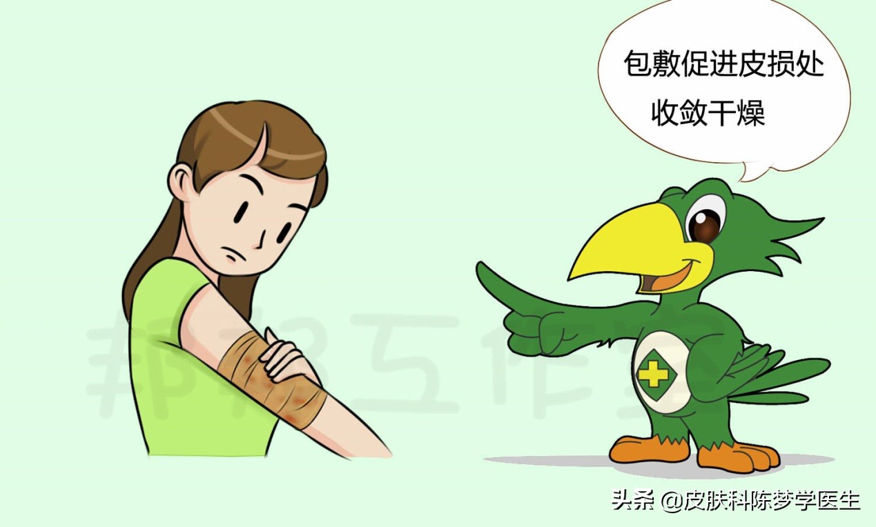 湿疹全身痒住院怎么检查治疗,湿疹红肿痒痒怎么治疗效果好