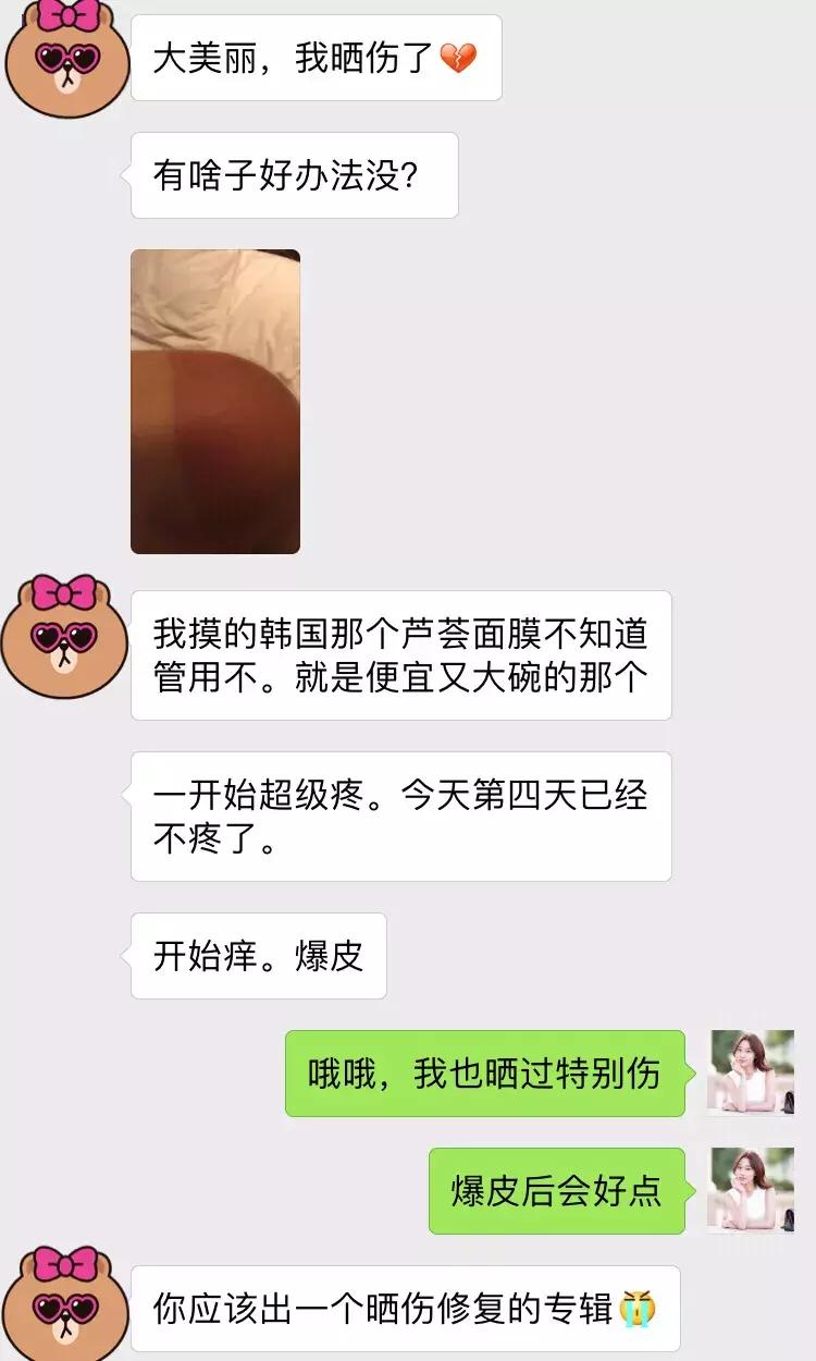 晒后修复四招拯救变成黑人的你