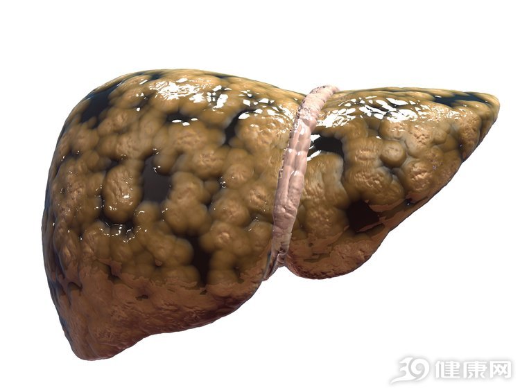 重视脂肪肝的危害,肝开始有问题将如何预防